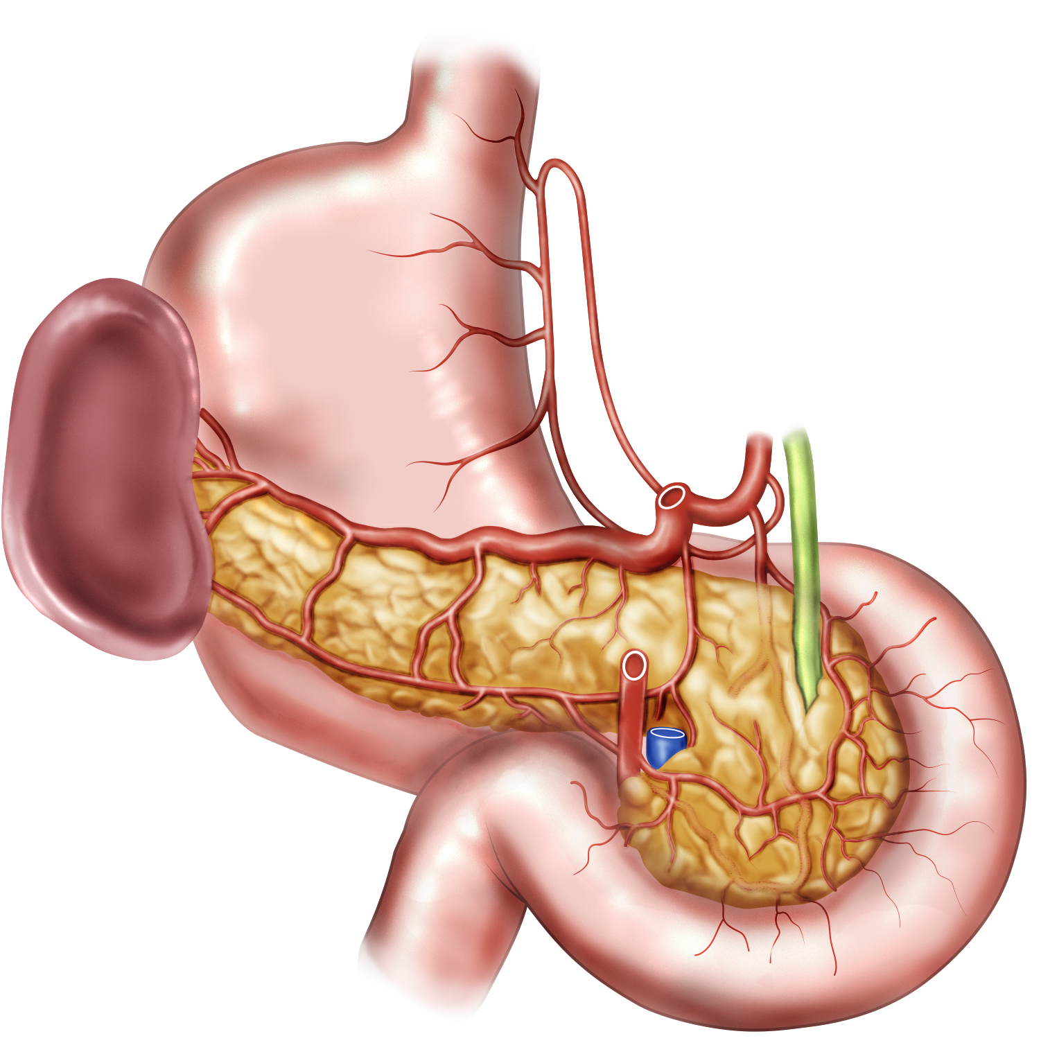 Anatomical illustration of the stomach, pancreas, spleen, duodenum, pancreatic duct, and biliary tract.