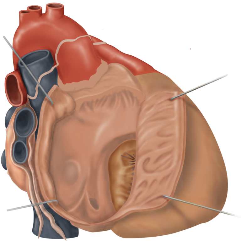 Anatomical cross-sectional illustration of the human heart showing the atria, ventricles, heart valves, and major blood vessels.