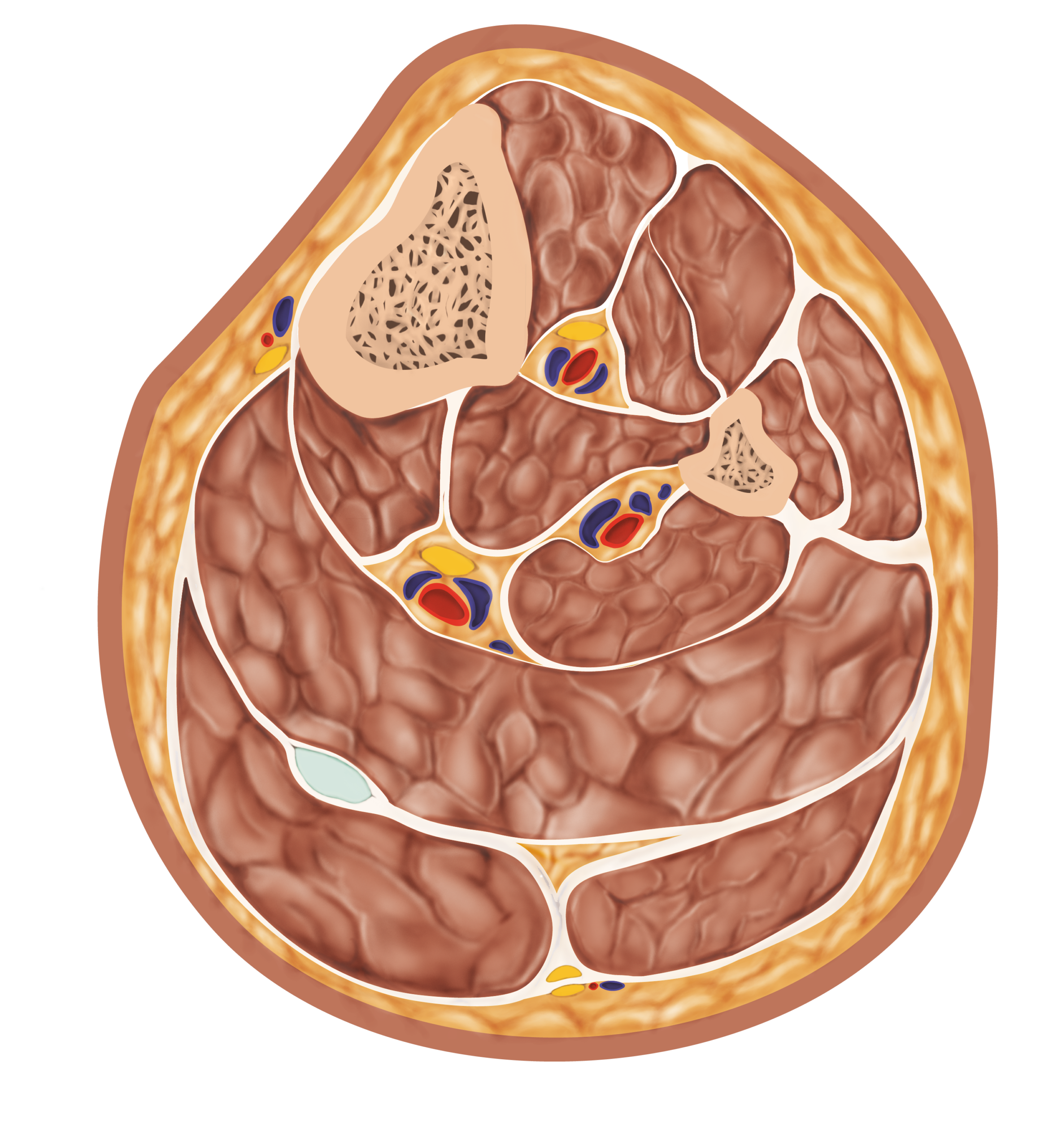 Anatomical cross-sectional illustration of the human thigh showing the femur, muscle compartments, blood vessels, nerves, and subcutaneous tissue.